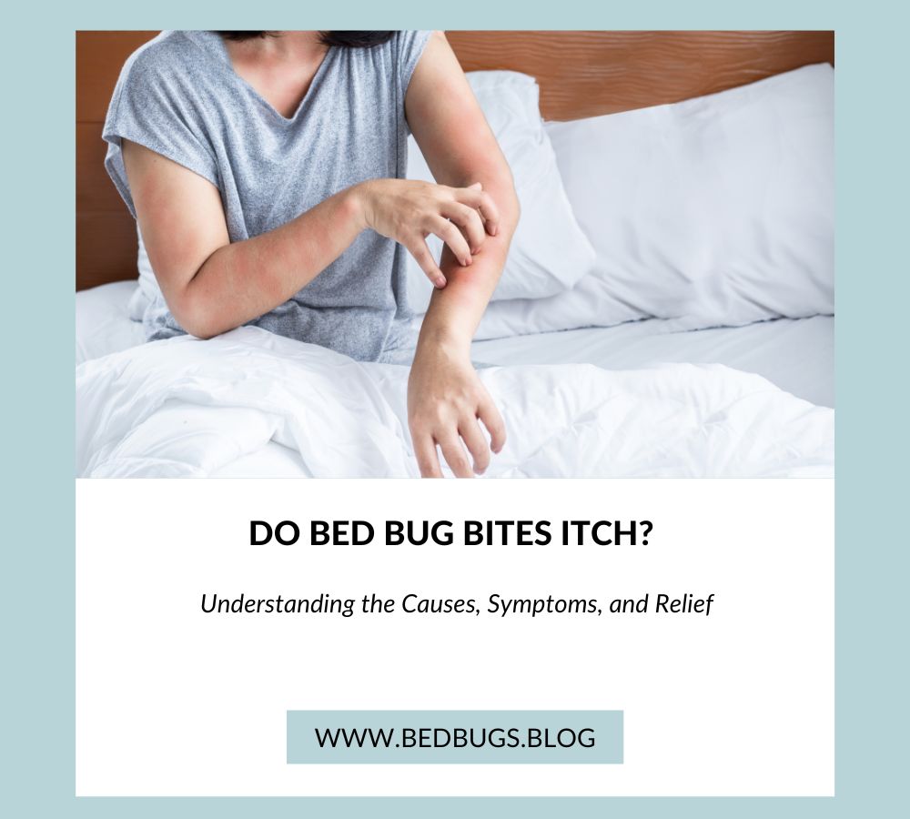 Do Bed Bug Bites Itch