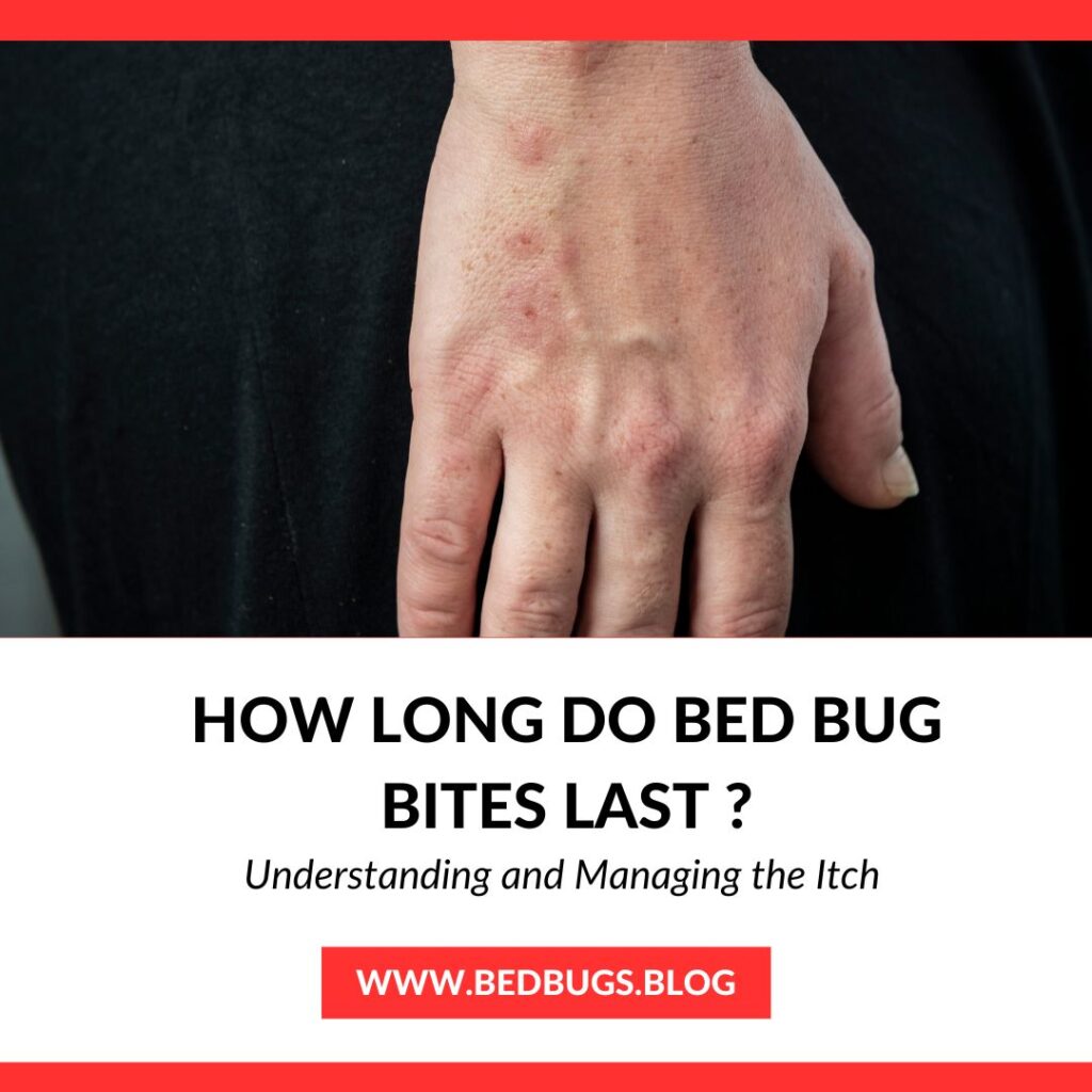 How Long Do Bed Bug Bites Last