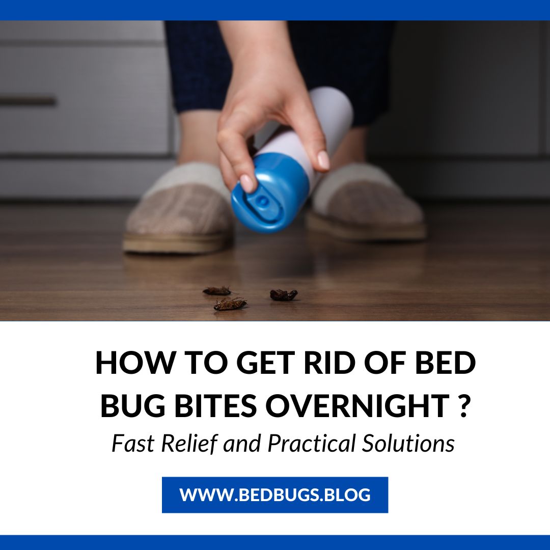 How to Get Rid of Bed Bug Bites Overnight ?