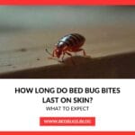 How Long Do Bed Bug Bites Last on Skin ?