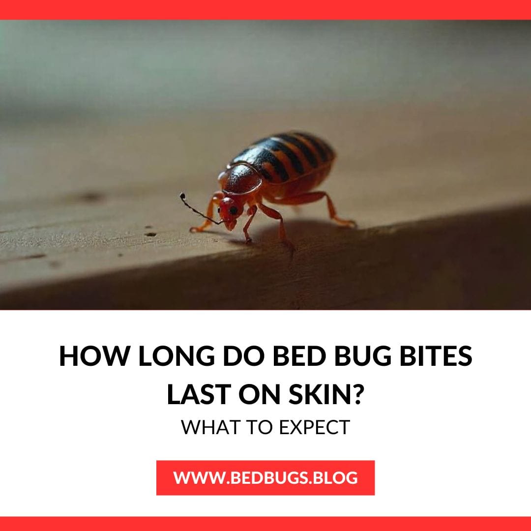 How Long Do Bed Bug Bites Last on Skin ?